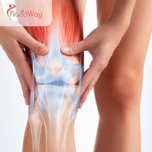 Knee Replacement Surgery in Mexico: High-Quality, Affordable Joint Surgery for Texas Patients